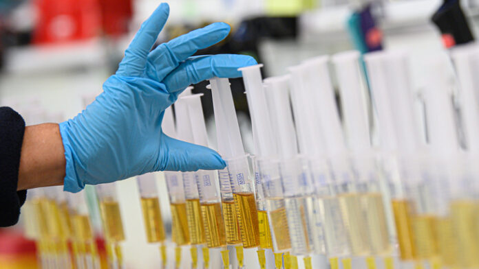 italjanskogo-beguna-diskvalificirovali-na-36-let-za-doping-9d6080d
